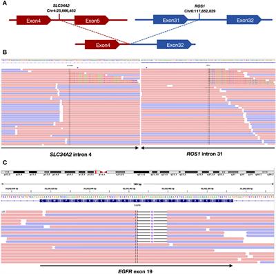 Remarkable response to third-generation EGFR-TKI plus crizotinib in a patient with pulmonary adenocarcinoma harboring EGFR and ROS1 co-mutation: a case report